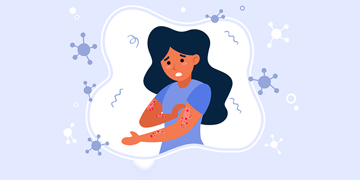 Her an herkes uyuz olabilir!