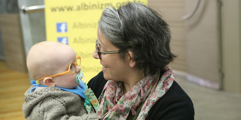 “En Güzel Beyaz Albinizm”