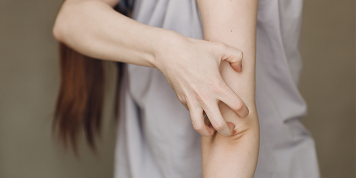 Uyuz salgınında tehlike geçmedi