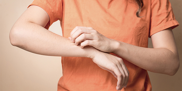 Uyuzda tedavi mümkün mü?