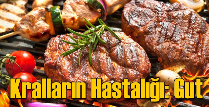 Kralların Hastalığı: Gut