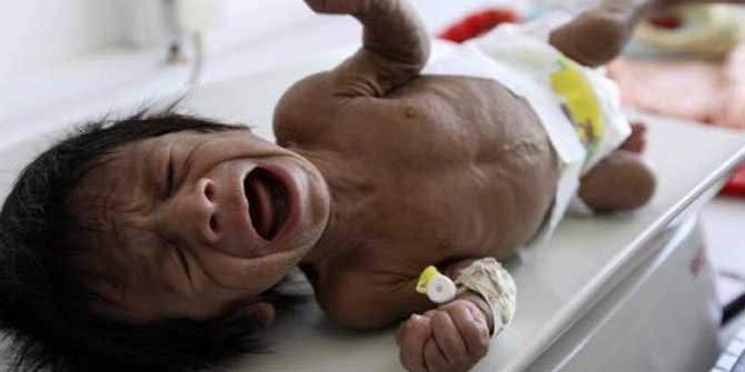 1945'ten Beri En Büyük İnsani Kriz!