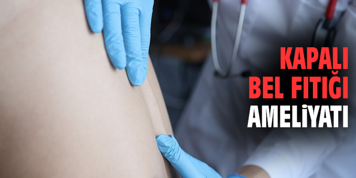 Kapalı Bel Fıtığı Ameliyatı