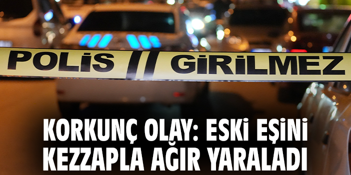 Korkunç olay: Eski eşini kezzapla ağır yaraladı