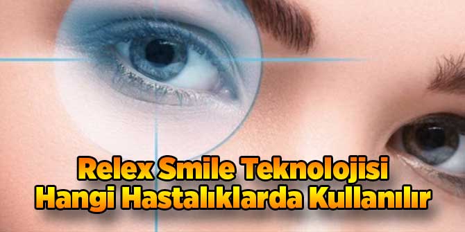 Relex Smıle Teknolojisi Hangi Hastalıklarda Kullanılır?