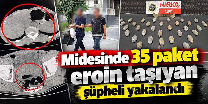 Midesinde 35 paket eroin taşıyan şüpheli yakalandı