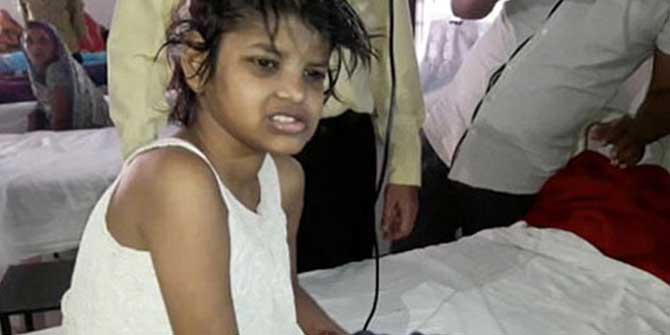 Maymunların Büyüttüğü Kızla İlgili Şok İddia