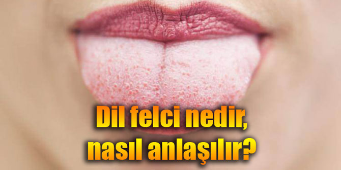 Dil felci nedir, nasıl anlaşılır?