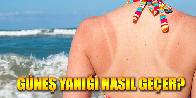 Güneş Yanığı Nasıl Geçer?