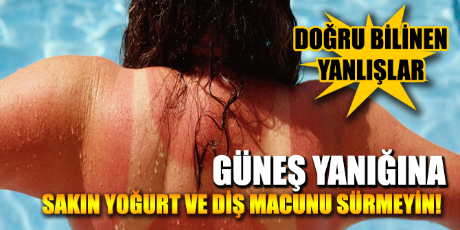 Güneş yanıklarında doğru bilinen yanlışlar