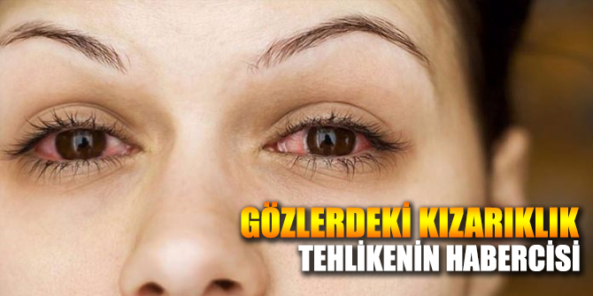 Gözlerde oluşan kızarıklıklar tehlikenin haberisi