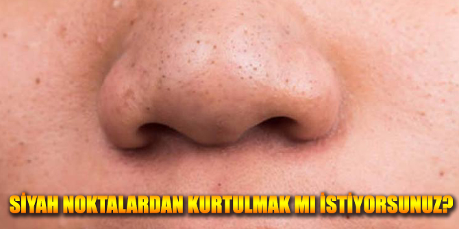 Siyah Noktalardan Kurtulmak istiyor musunuz?