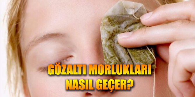 Gözaltı morluklarından kurtulabilirsiniz