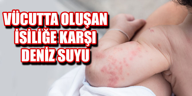 Vücutta oluşan isiliğe karşı deniz suyu