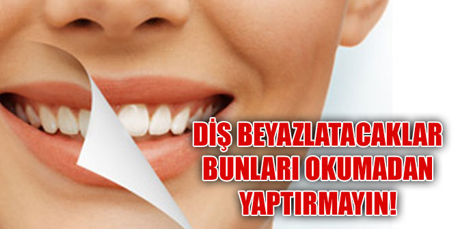 Diş beyazlatacaklar bunları okumadan yaptırmayın