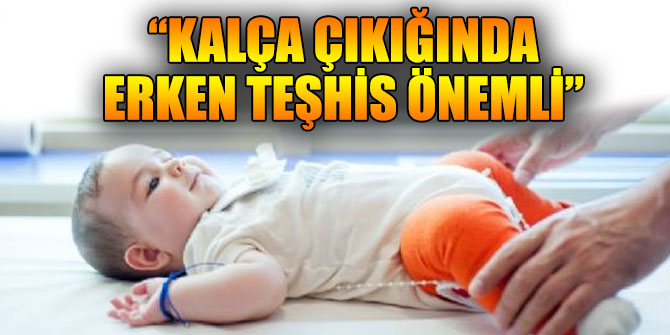 “Kalça çıkığında erken teşhis önemli”