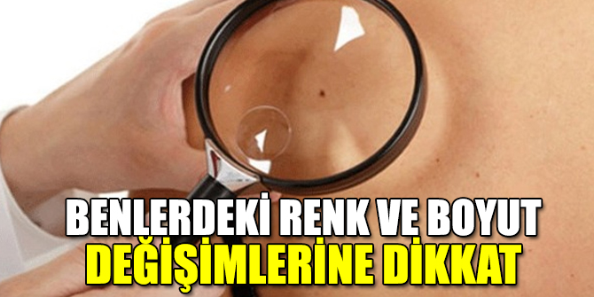 Benlerdeki renk ve boyut değişimlerine dikkat