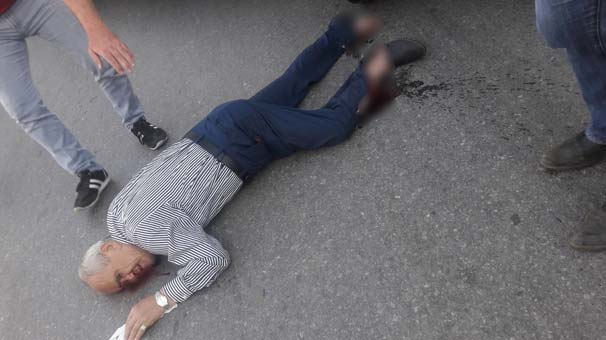 Otobüsün altında kalan yaşlı adamın ayağı koptu