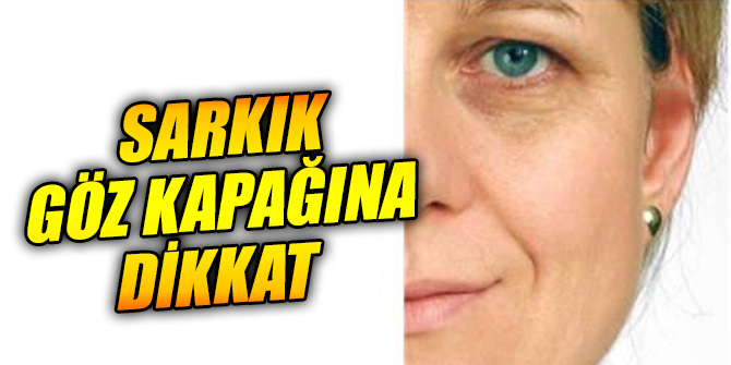 Sarkık göz kapağına dikkat