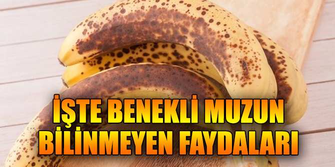 İşte benekli muzun bilinmeyen faydaları