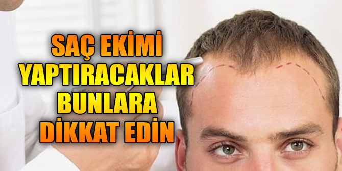 Saç ekimi yaptıracaklar bunlara dikkat edin