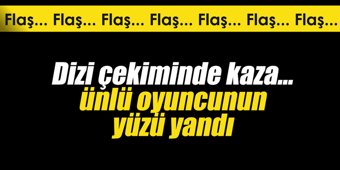 Dizi çekiminde kaza... Ünlü oyuncunun yüzü yandı