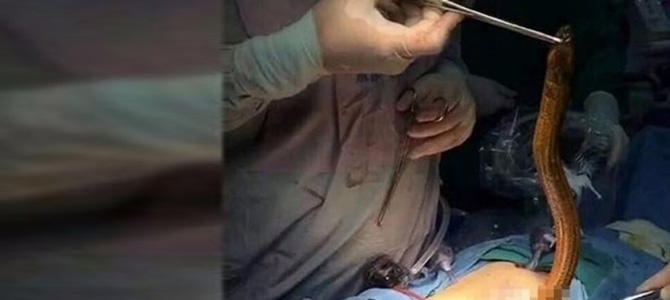 Karın ağrısı diye gitti, içinden bu çıktı