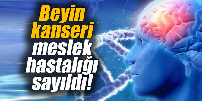 Beyin kanseri meslek hastalığı sayıldı!