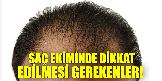 Uzmanlar açıkladı! İşte saç ekiminde dikkat edilmesi gerekenler