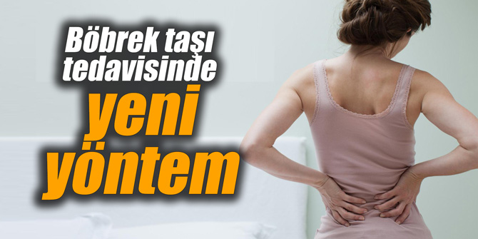 Böbrek taşı tedavisinde yeni yöntem