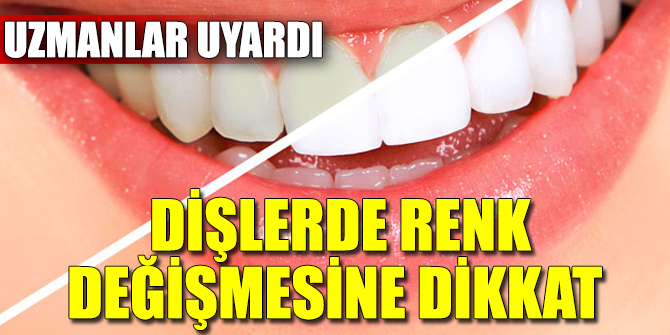 Uzmanlar uyardı! Dişlerde renk değişmesine dikkat
