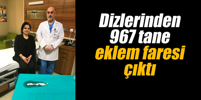 Dizlerinden 967 tane eklem faresi çıktı