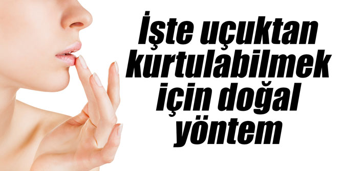 İşte uçuktan kurtulabilmek için doğal yöntem