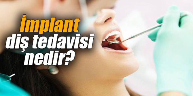İmplant diş tedavisi nedir?