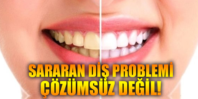 Sararan diş probleminden kurtulmak mümkün!