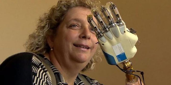 Hisleri iletebilen ilk taşınabilir biyonik el geliştirildi