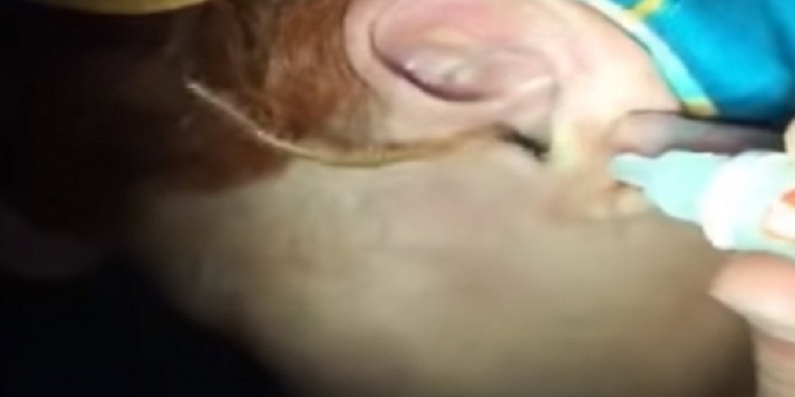 Kulağından kırkayak çıktı! İşte o görüntüler