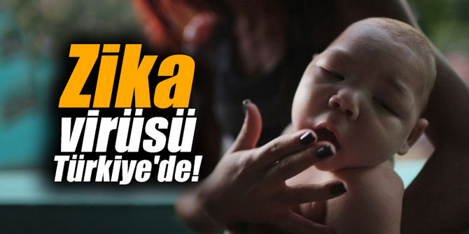 Zika virüsü Türkiye'de!