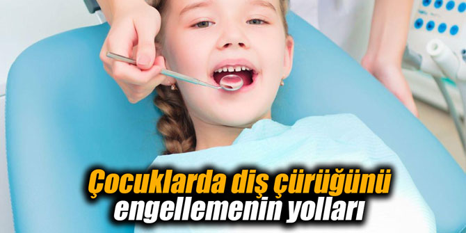Çocuklarda diş çürüğünü engellemenin yolları