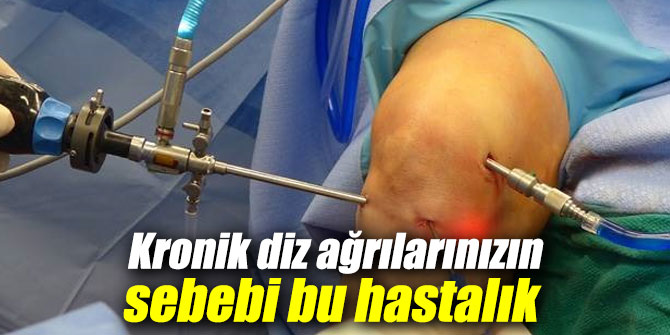 Kronik diz ağrılarınızın sebebi bu hastalık