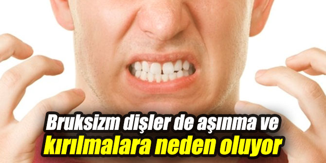 Bruksizm dişler de aşınma ve kırılmalara neden oluyor