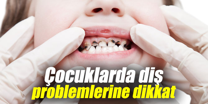 Çocuklarda diş problemlerine dikkat