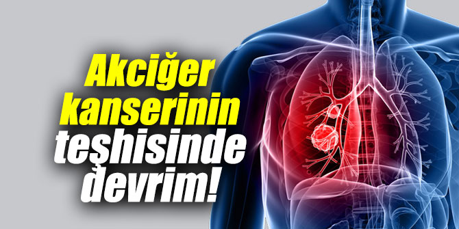 Akciğer kanserinin teşhisinde devrim