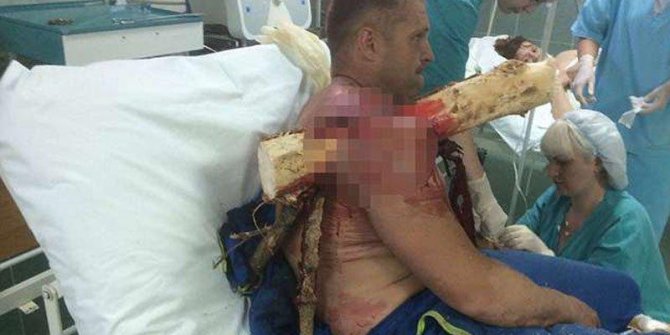 Hastaneye böyle getirildi… Doktorlar bile şok oldu