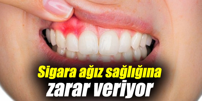 Sigara ağız sağlığını tehdit ediyor