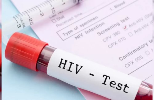 hiv-nedir-1170x759jpg.webp