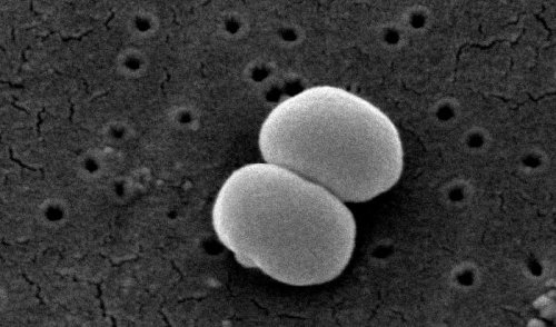 staphylococcus-epidermidis-lores.jpg