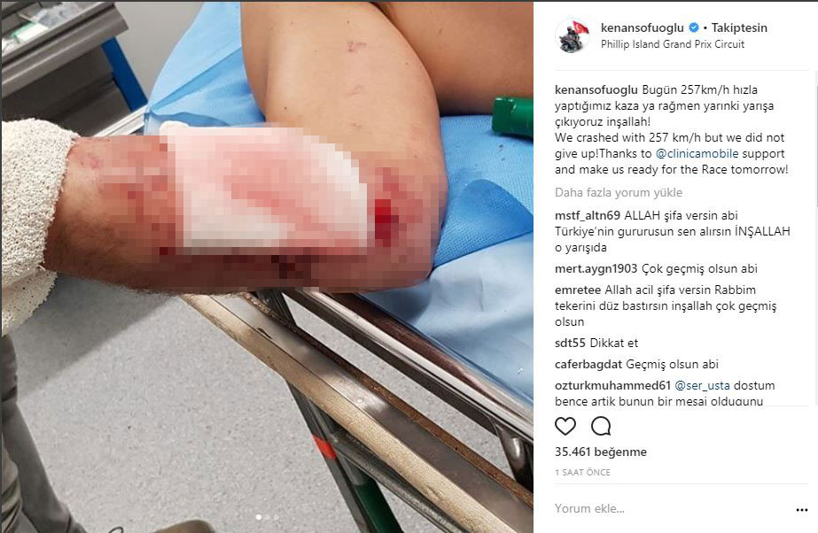 206_kenan-sofuoglu-kaza.jpg