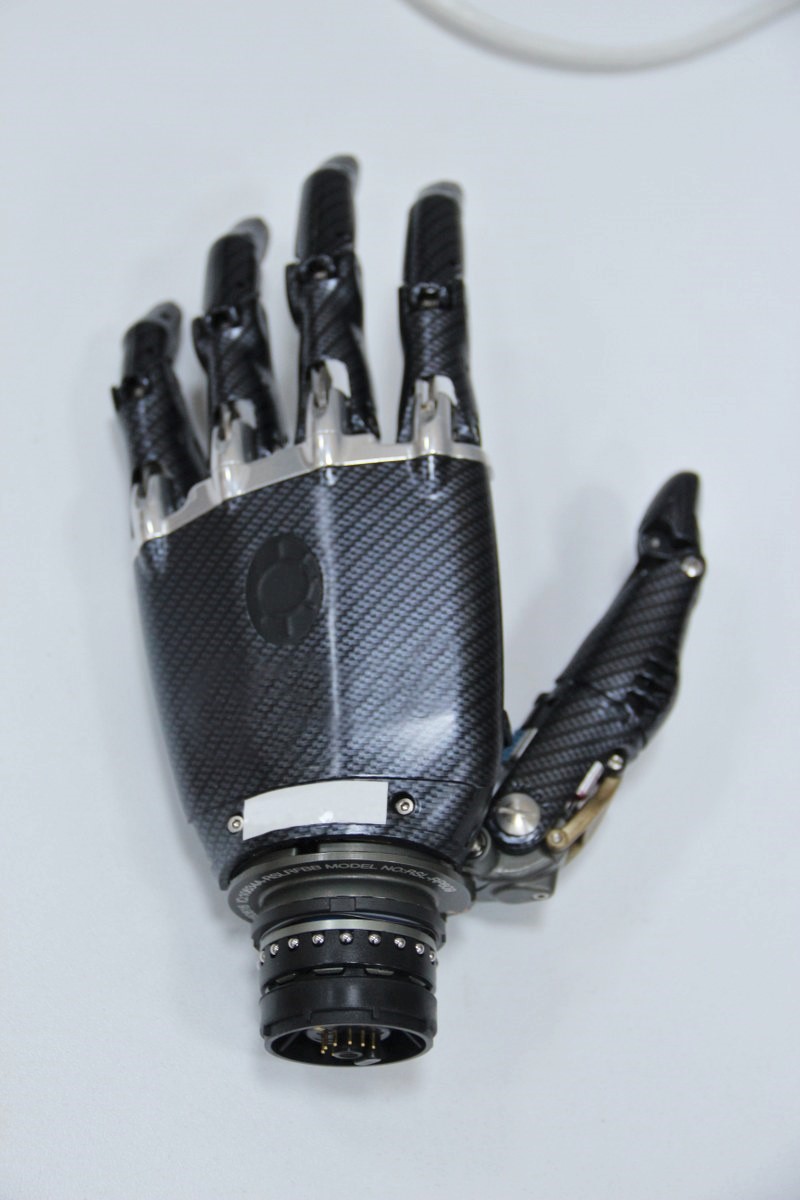 elektronik-kontrollu-protez-el-tasarimi.jpg